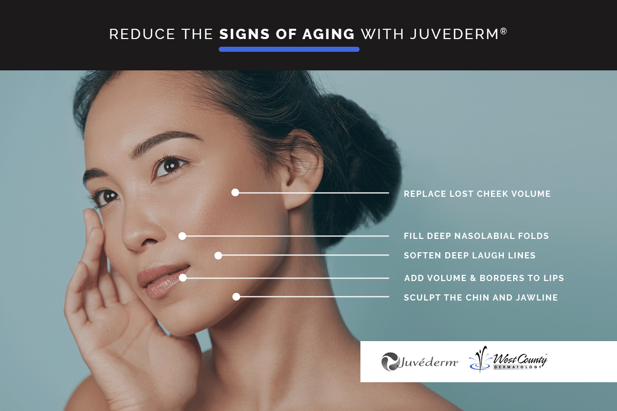With the hyaluronic acid-based Juvederm dermal filler, Chesterfield's West County Dermatology team can accomplish multiple cosmetic improvements on an aging face. With the hyaluronic acid-based Juvederm dermal filler, Chesterfield's West County Dermatology team can accomplish multiple cosmetic improvements on an aging face.